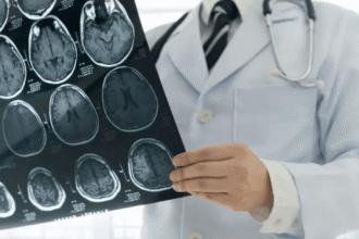 Stroke Tak Pandang Usia: Bayi Baru Lahir pun Berisiko Dokter ahli saraf menganalisis hasil MRI atau CT Scan otak untuk diagnosis stroke pada bayi baru lahir